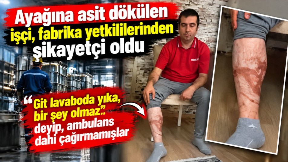 Ayağına asit dökülen işçi, fabrika yetkililerinden şikayetçi oldu